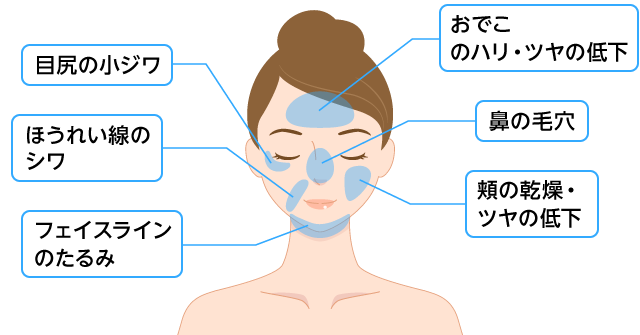 水光注射の施術箇所