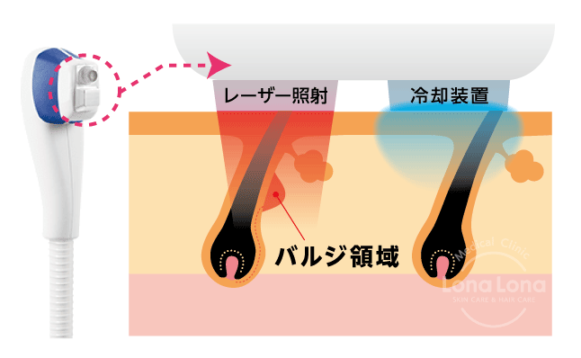 メディオスター