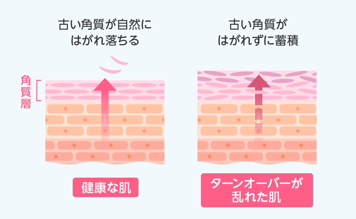 健康な肌とターンオーバーが乱れた肌の違い