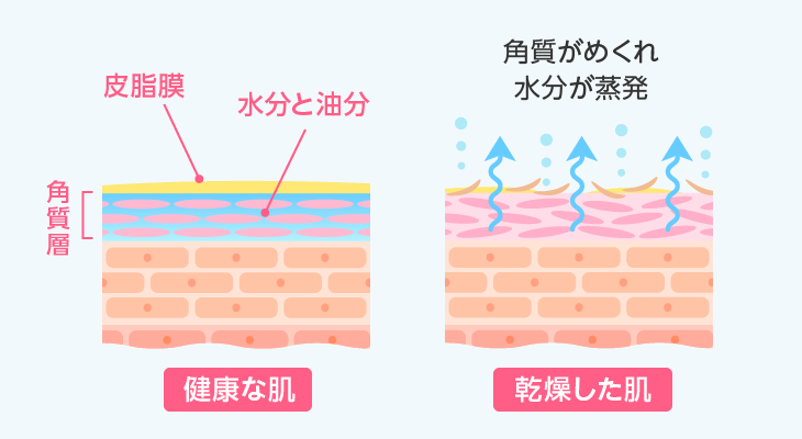 健康な肌と乾燥した肌の違い